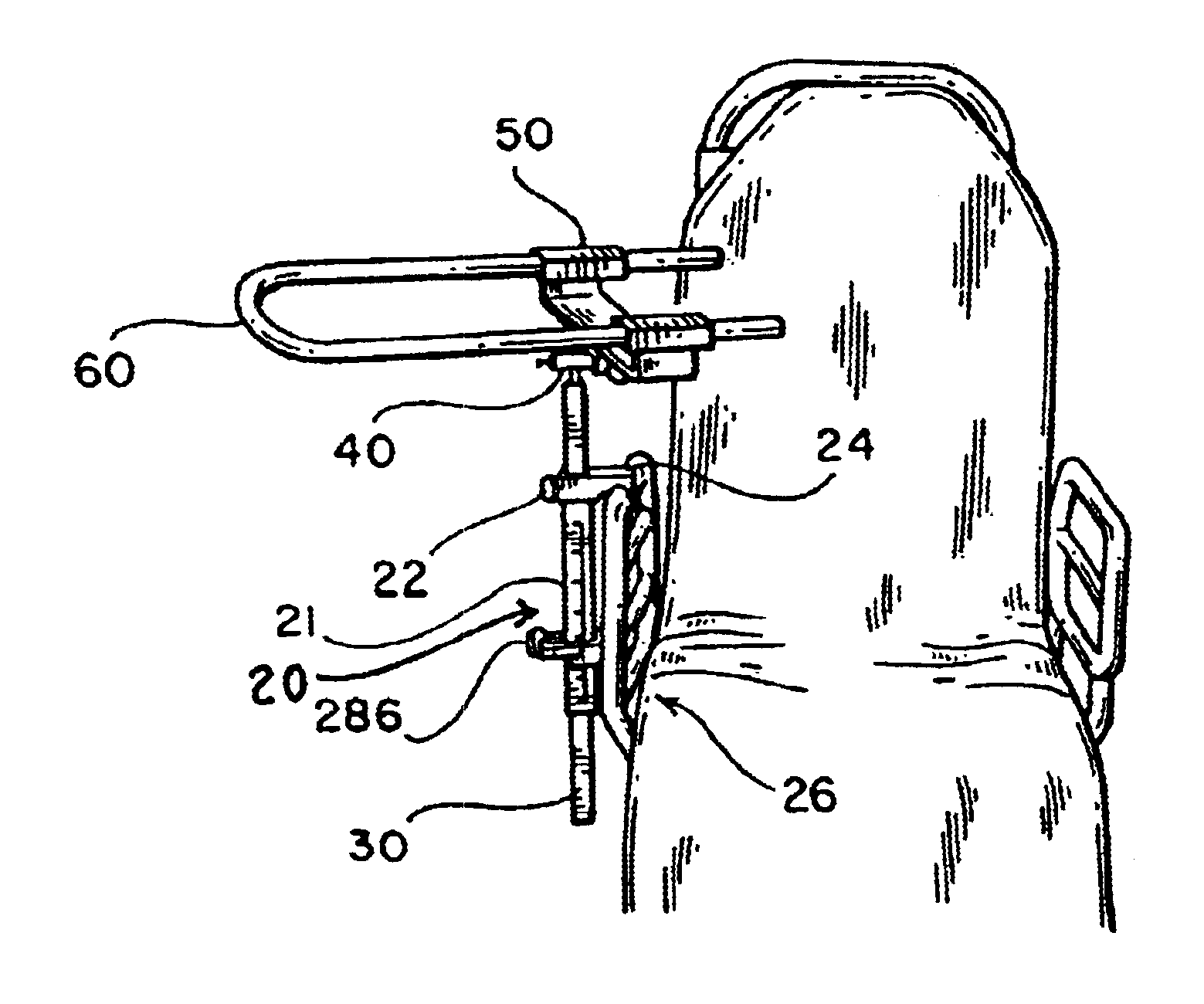Device for upper extremity elevation
