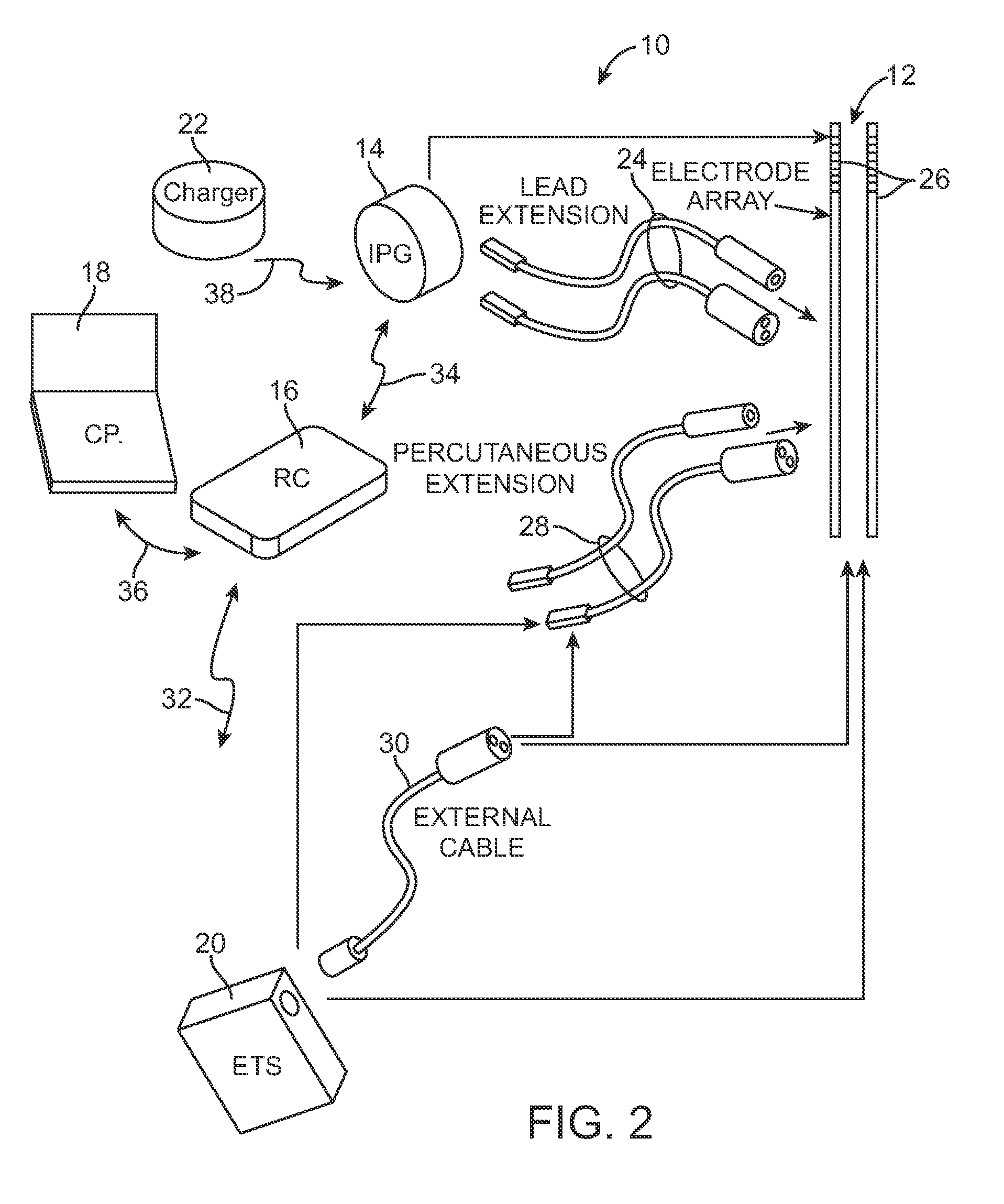 Methods to avoid frequency locking in a multi-channel neurostimulation system using pulse placement