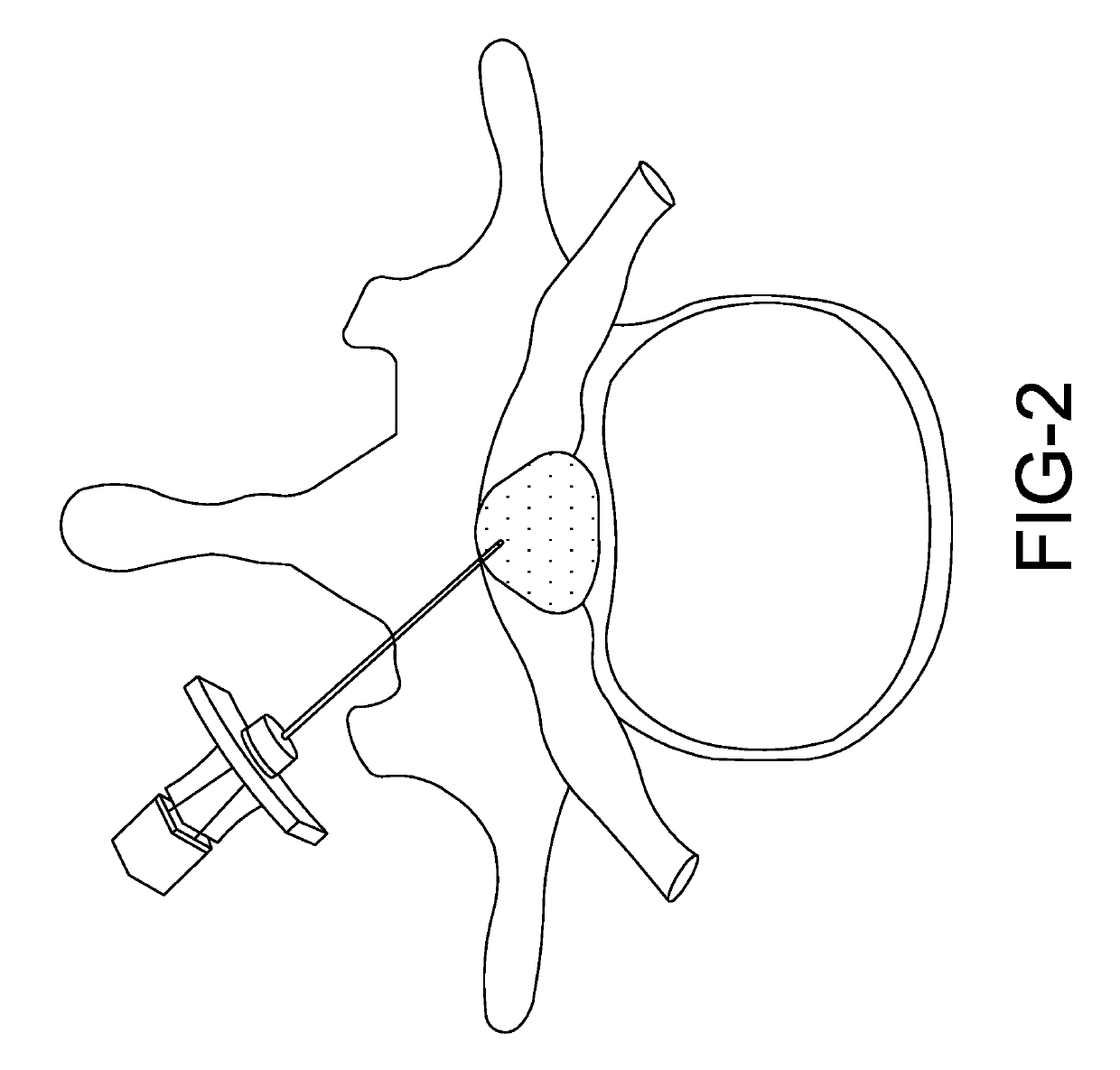 Biomarker detection and identification system and apparatus