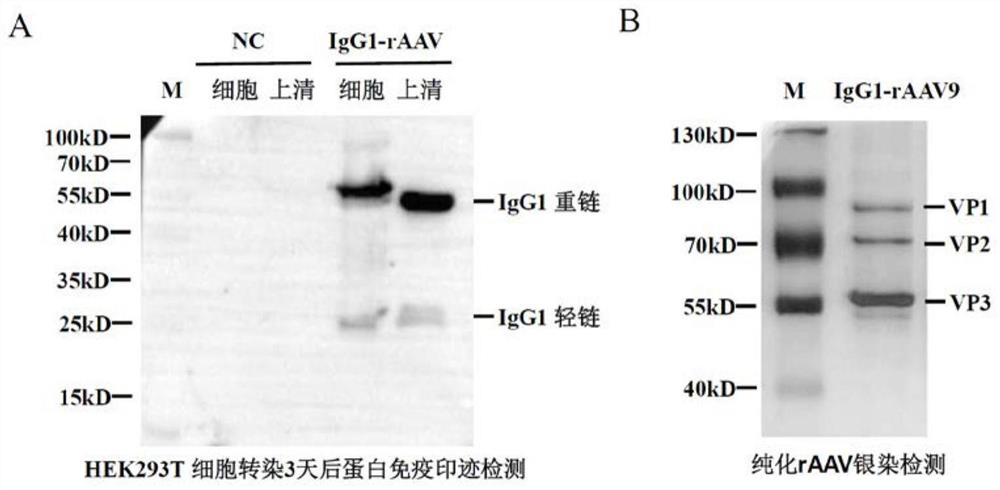 RAAV vector for expressing antibody IgG1 and application of rAAV vector