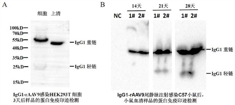 RAAV vector for expressing antibody IgG1 and application of rAAV vector