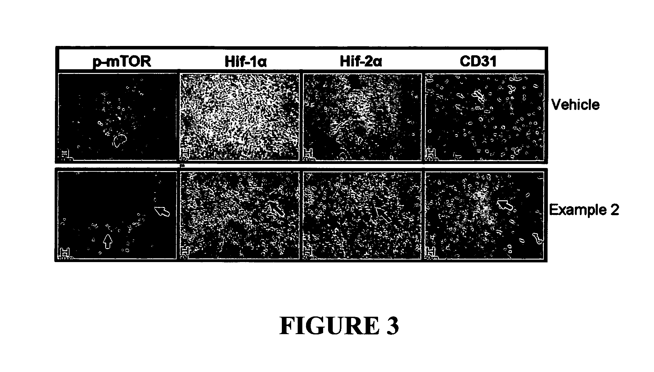 Combination therapy for treating proliferative diseases