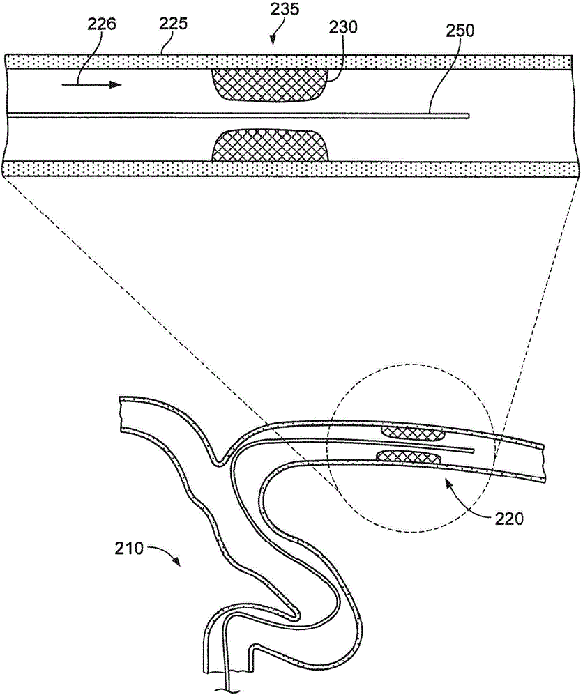 Devices and systems for thrombus treatment