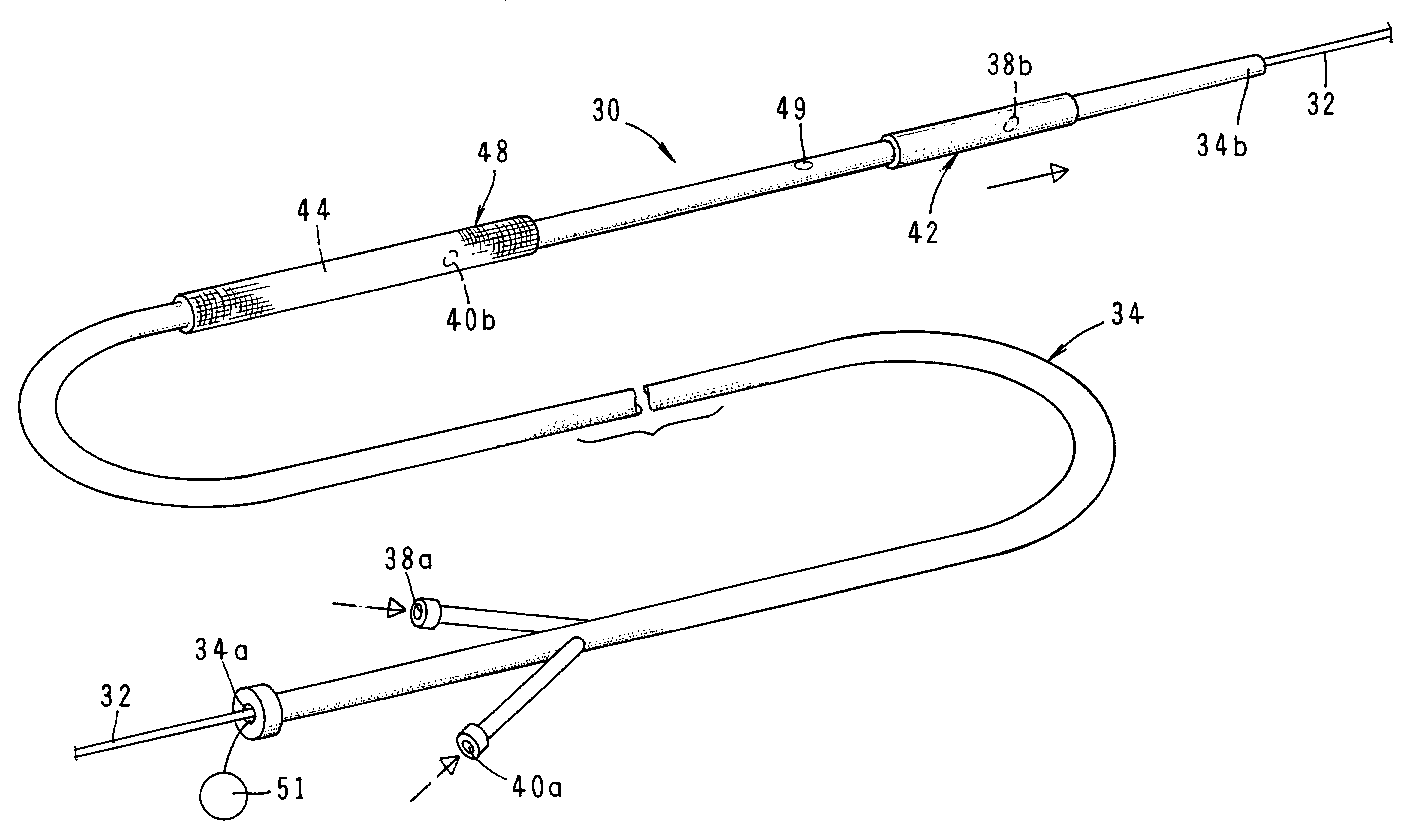 Stent with combined distal protection device