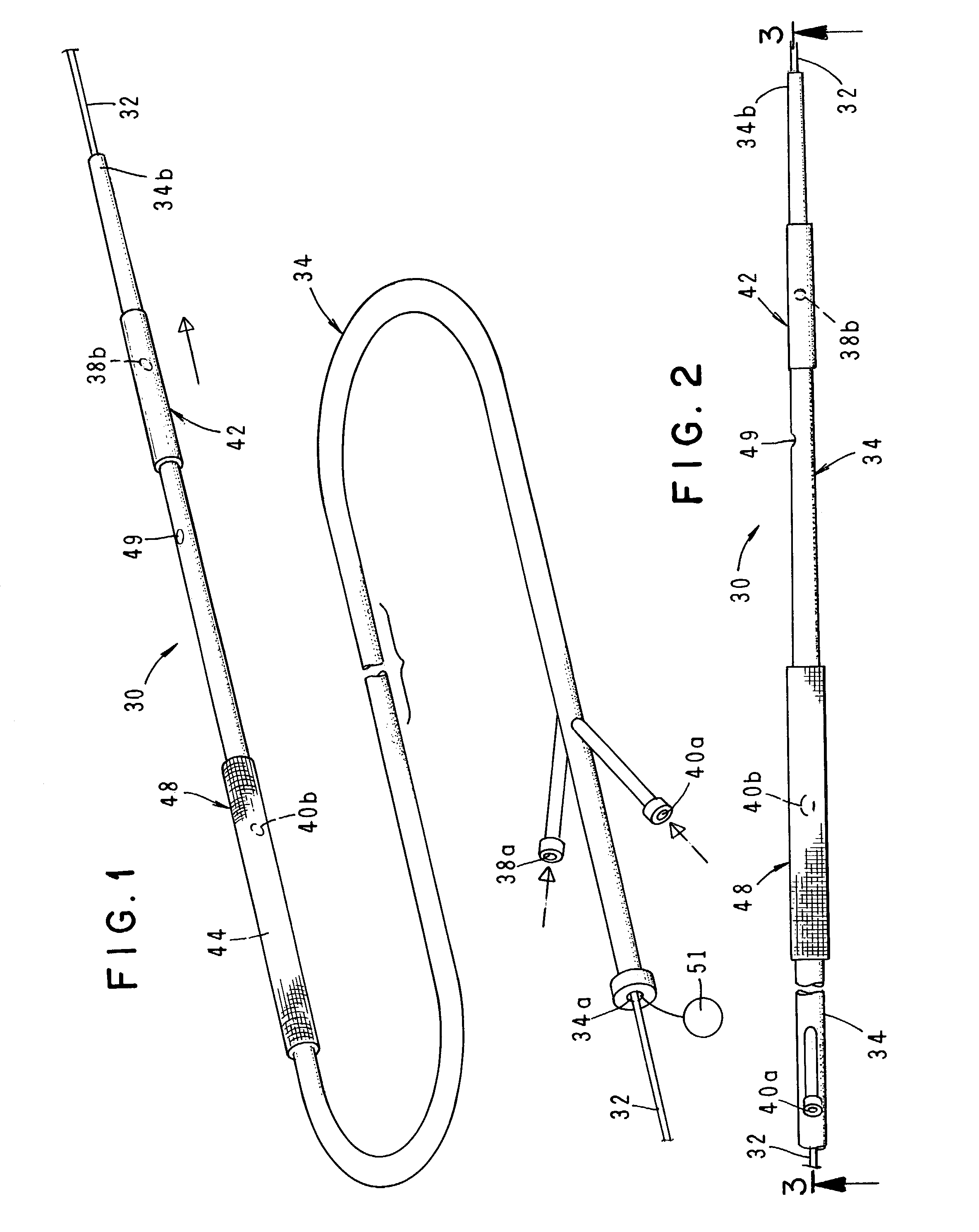 Stent with combined distal protection device