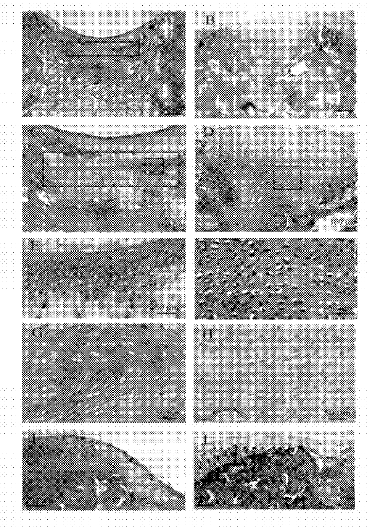 The use of midkine protein and the protein-containing medical device