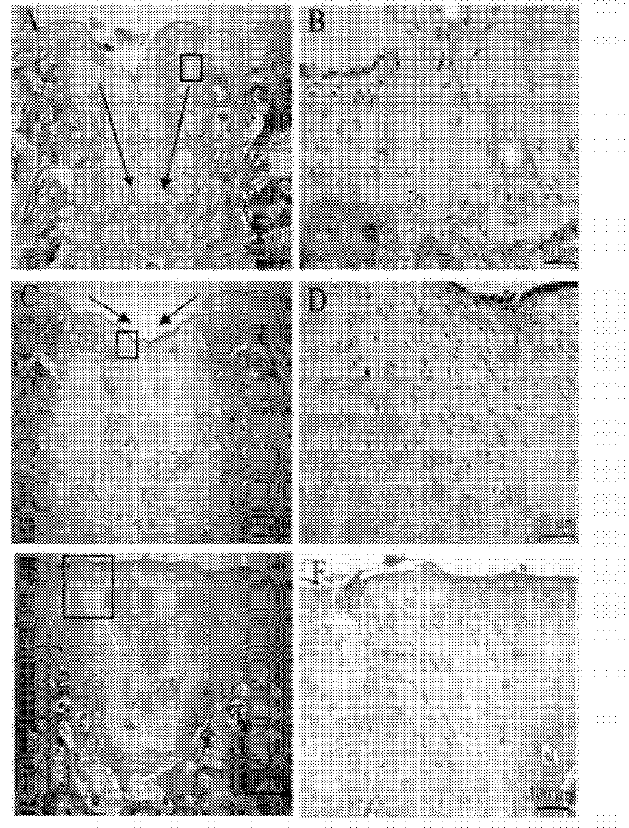 The use of midkine protein and the protein-containing medical device