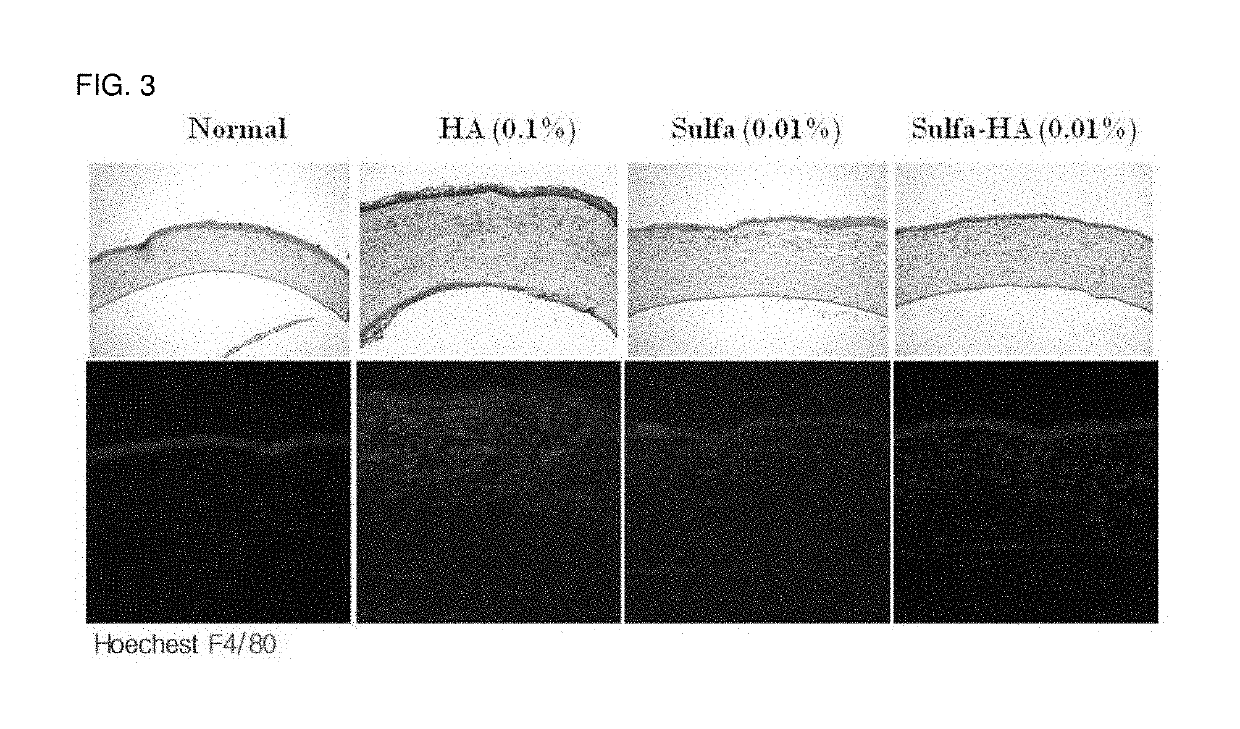 Eye drop composition for treating ocular inflammatory disease and preparation method therefor