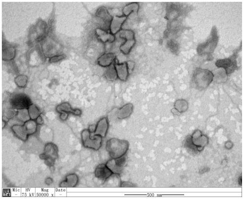 Purification method for rabies virus inactivated vaccine