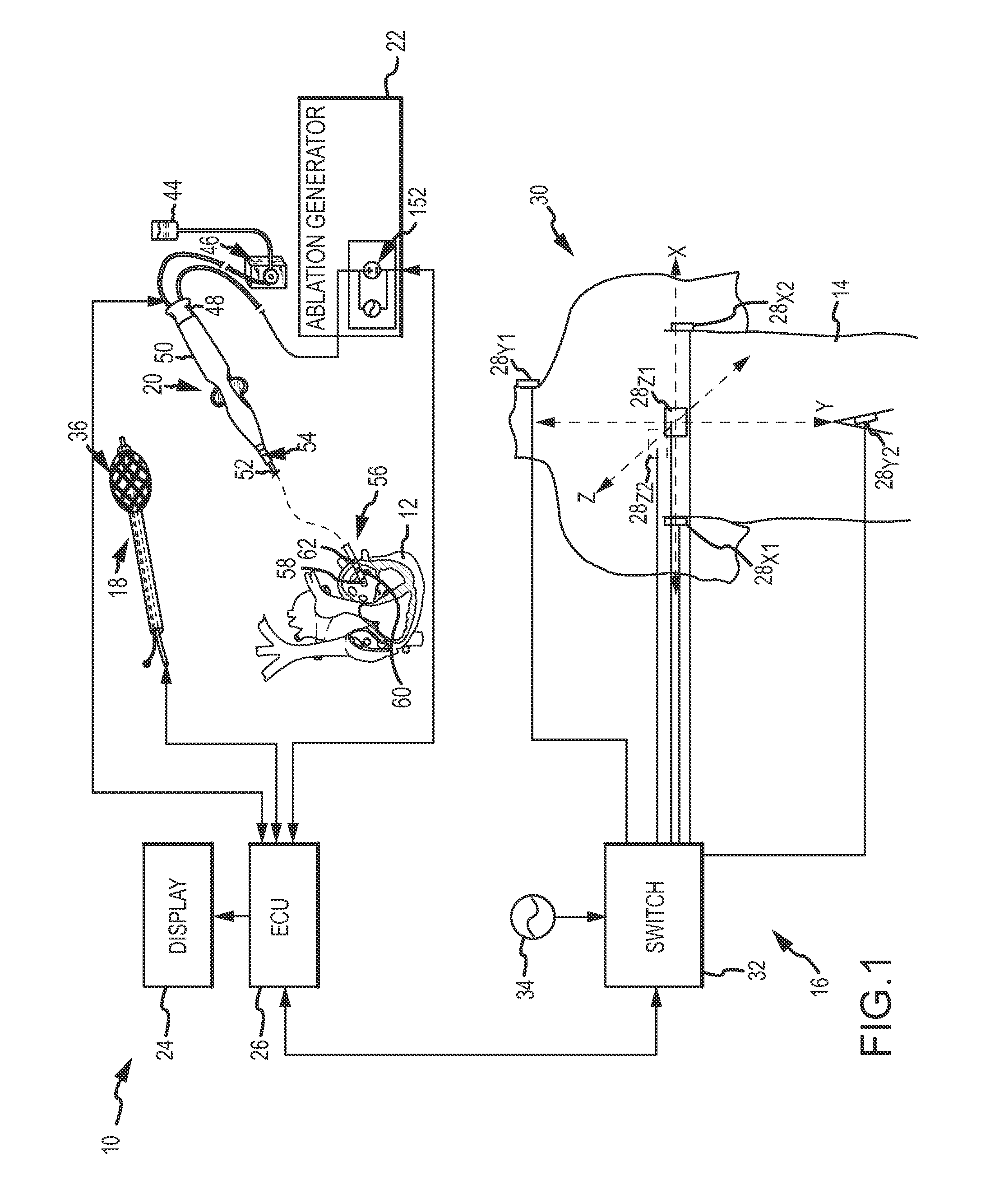 System for optimized coupling of ablation catheters to body tissues and evaulation of lesions formed by the catheters