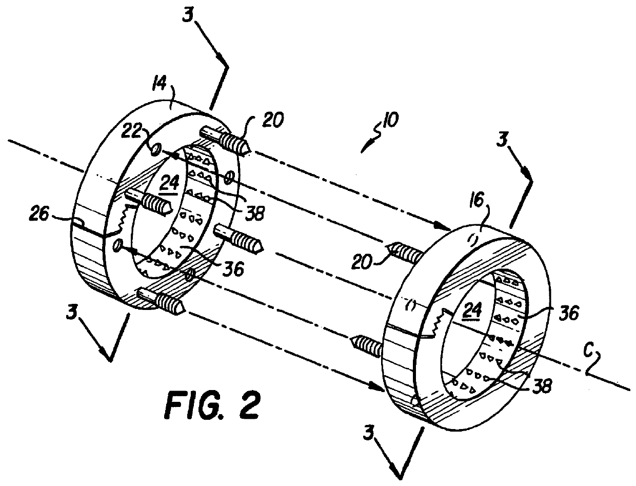 Anastomosis apparatus and method for anastomosing an anatomical tubular structure