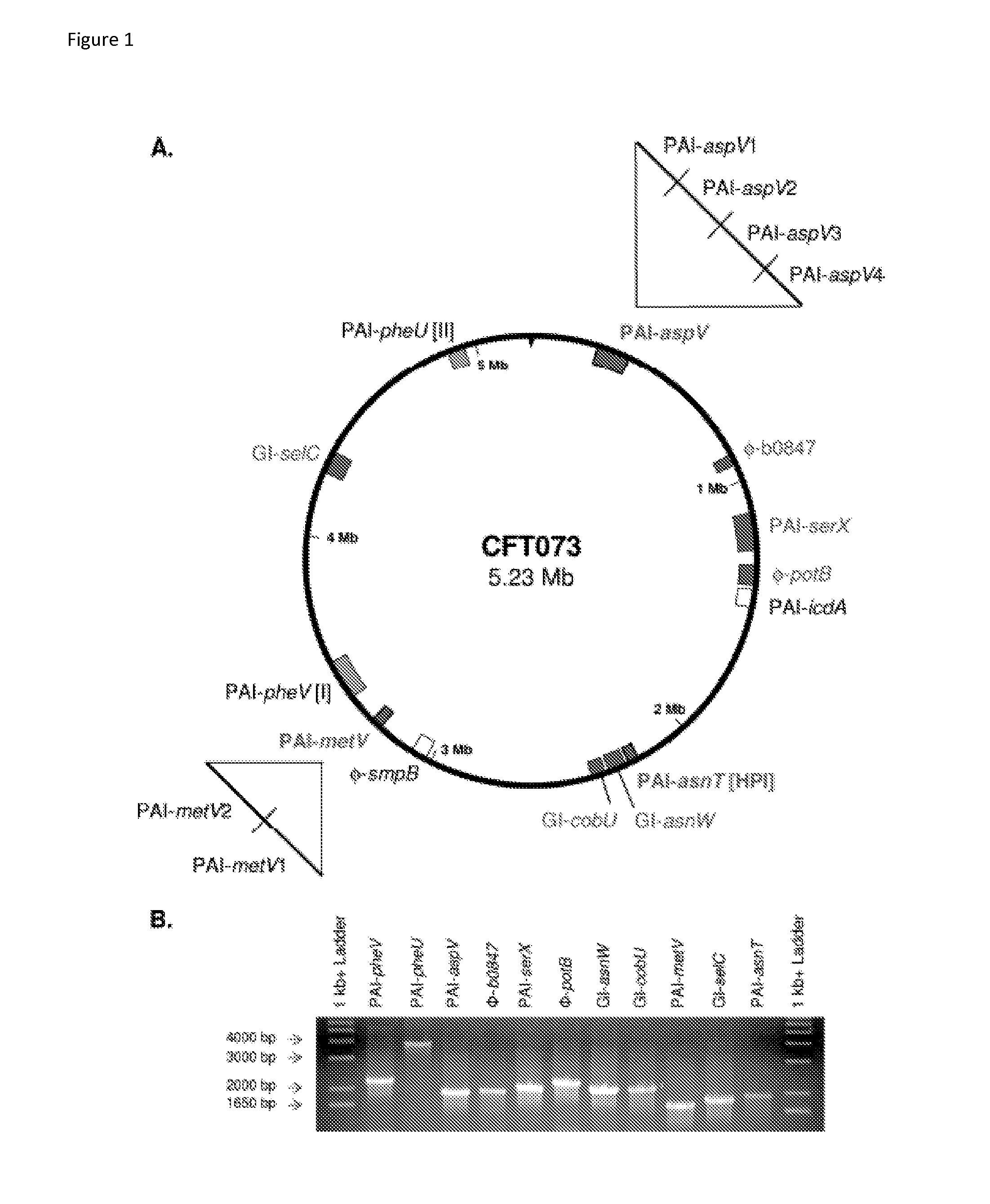 Compositions and methods for diagnosing and treating urinary tract infections