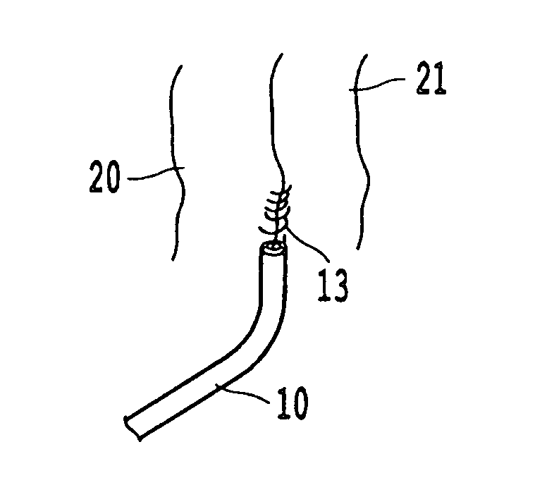 Methods and articles for treatment of rectal prolapse