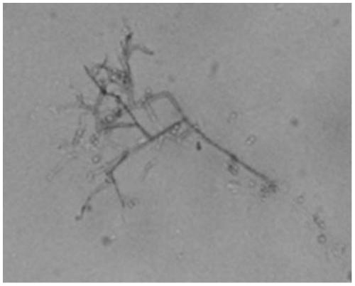 A kind of trichoderma dark green strain and application thereof