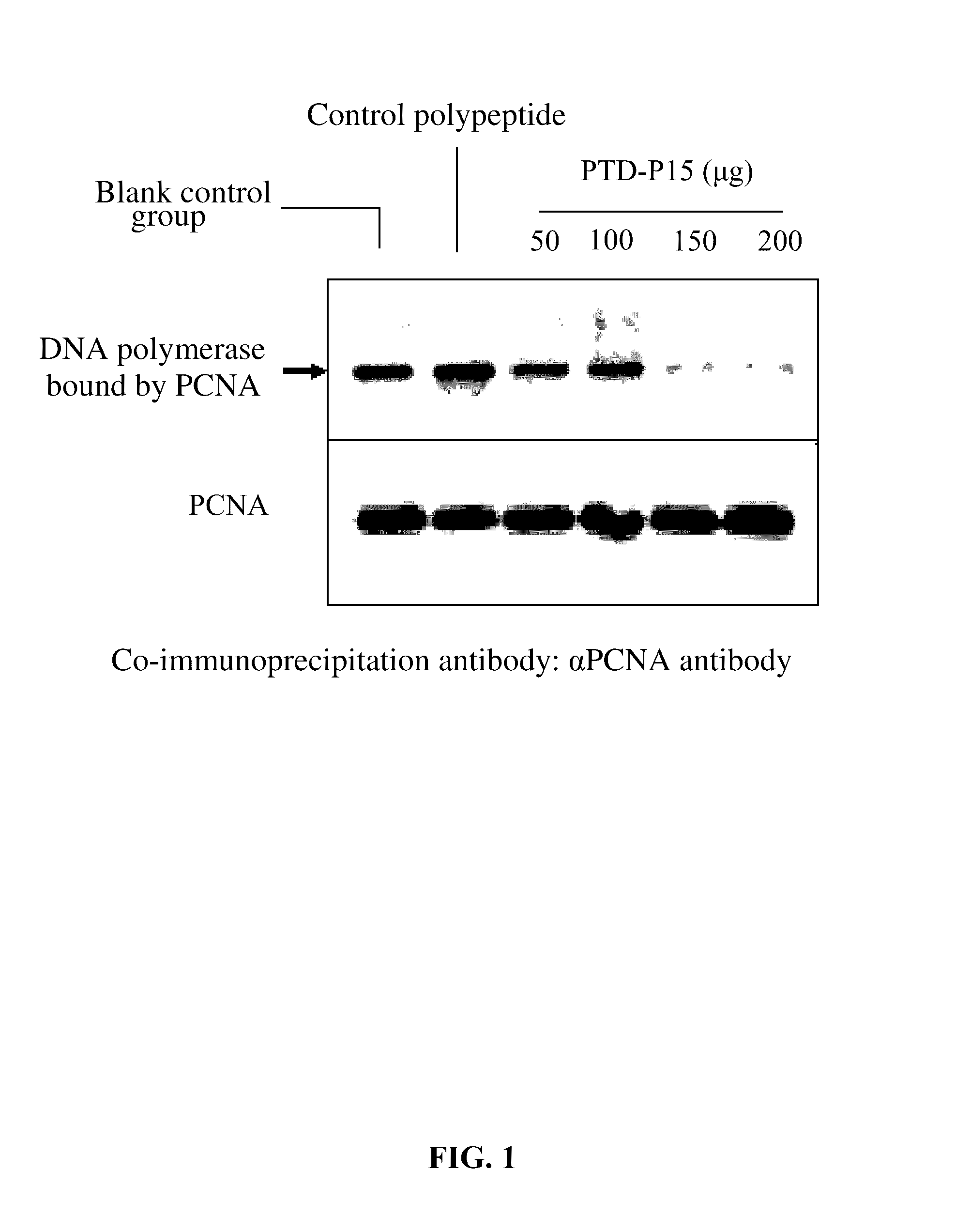 Polypeptide, nucleotide sequence thereof, and method for using the same for preventing DNA synthesis and inhibiting cell proliferation