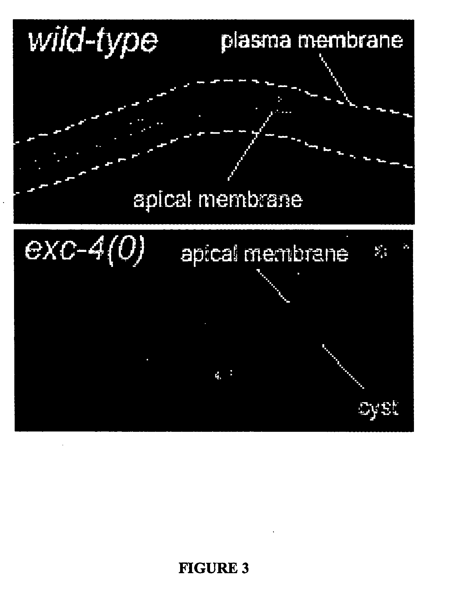 Method of screening for agents inhibiting chloride intracellular channels