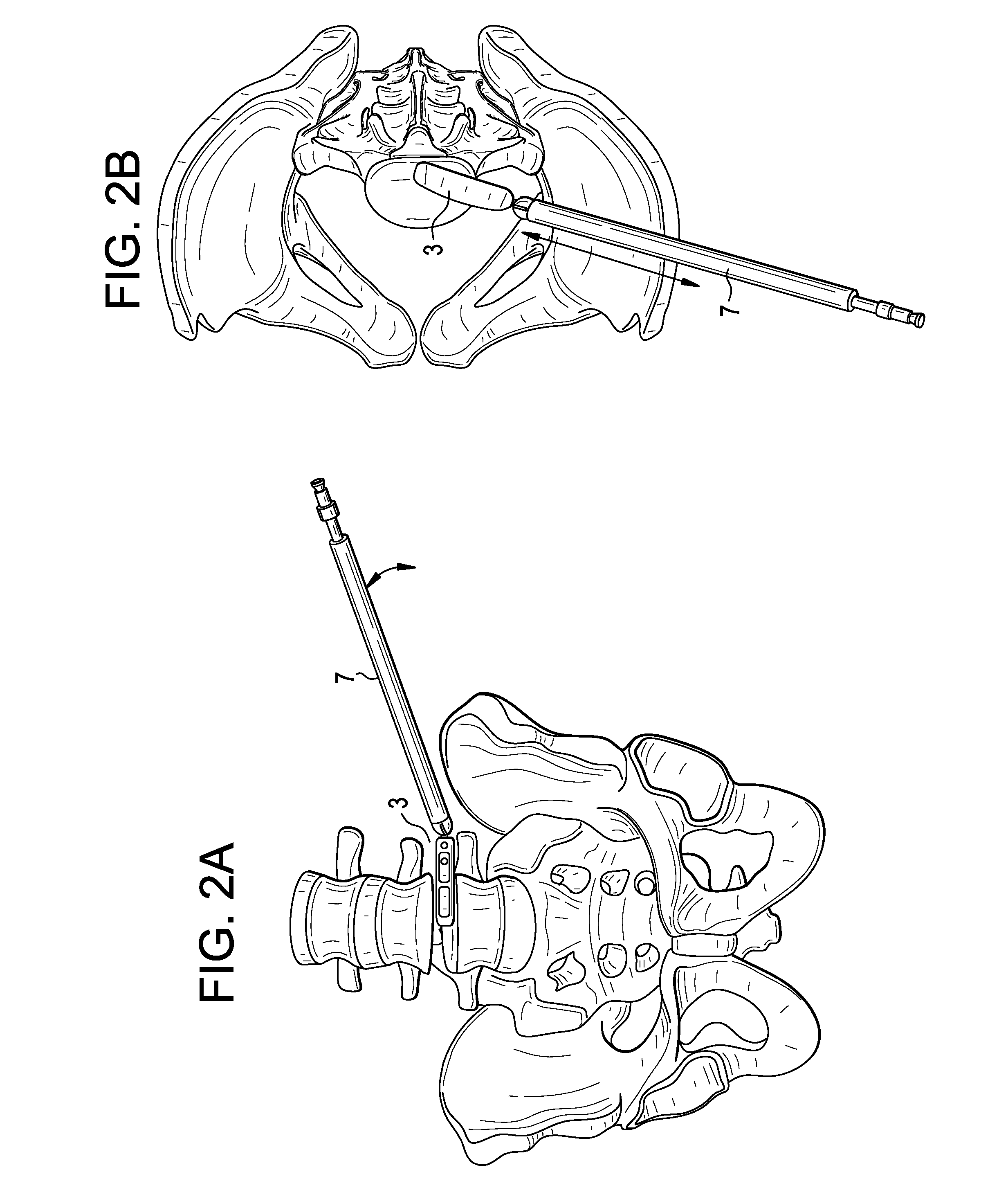 Polyaxial Articulating Instrument