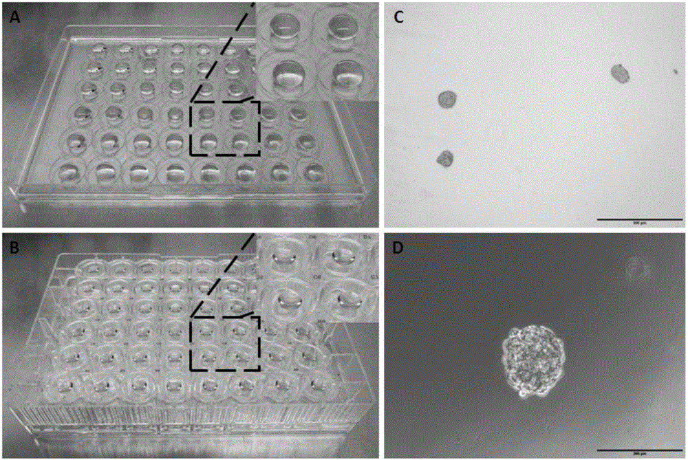 Preparation method of cancer cell ball and application