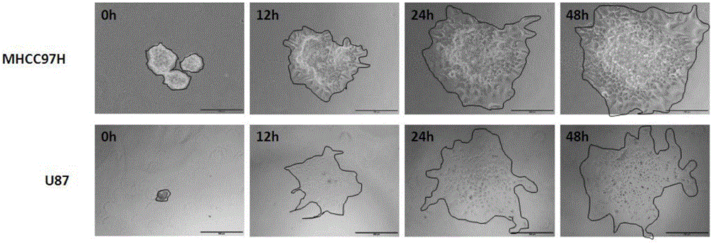 Preparation method of cancer cell ball and application