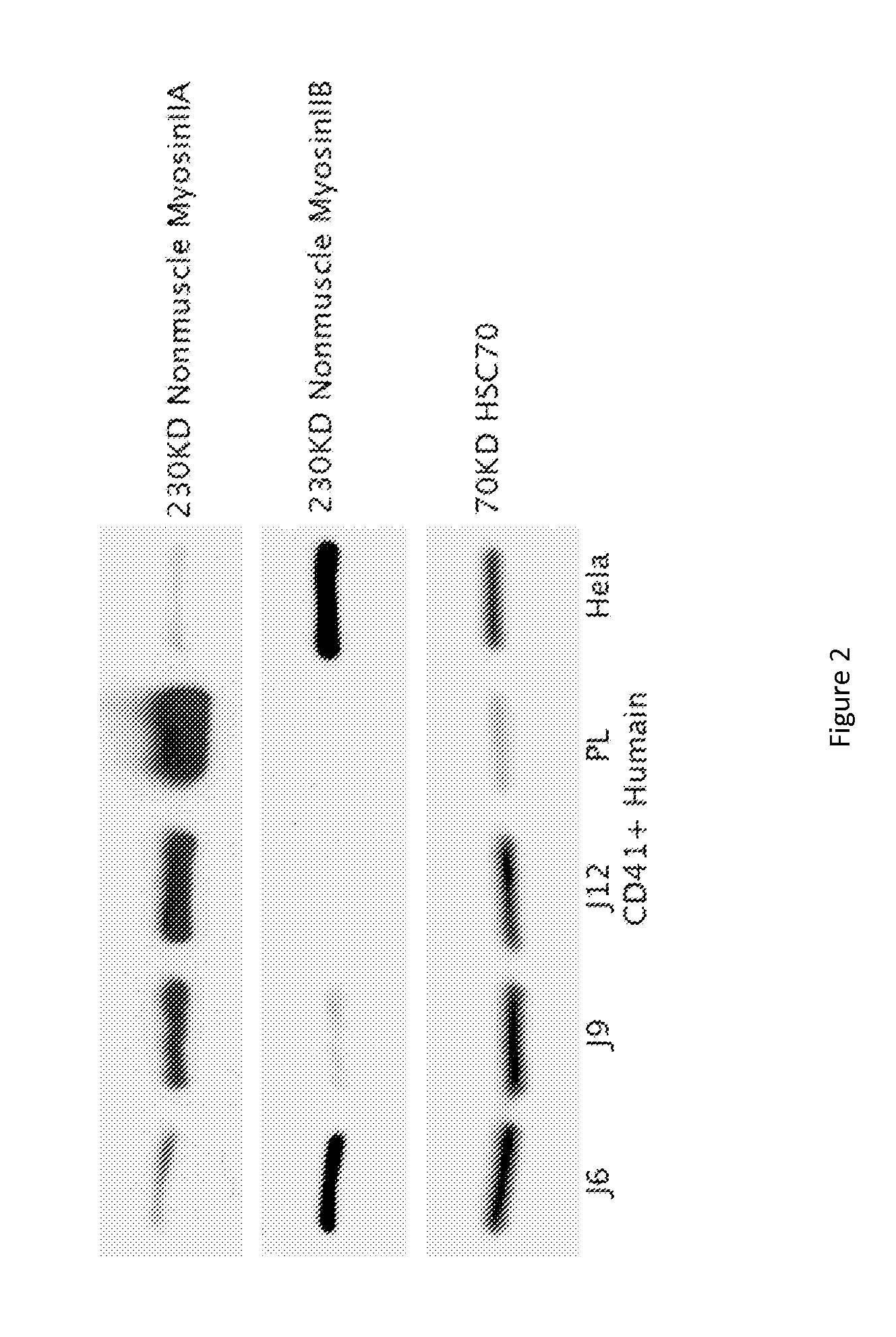 Myh10 as a new marker of pathologies resulting from runx1 inactivation