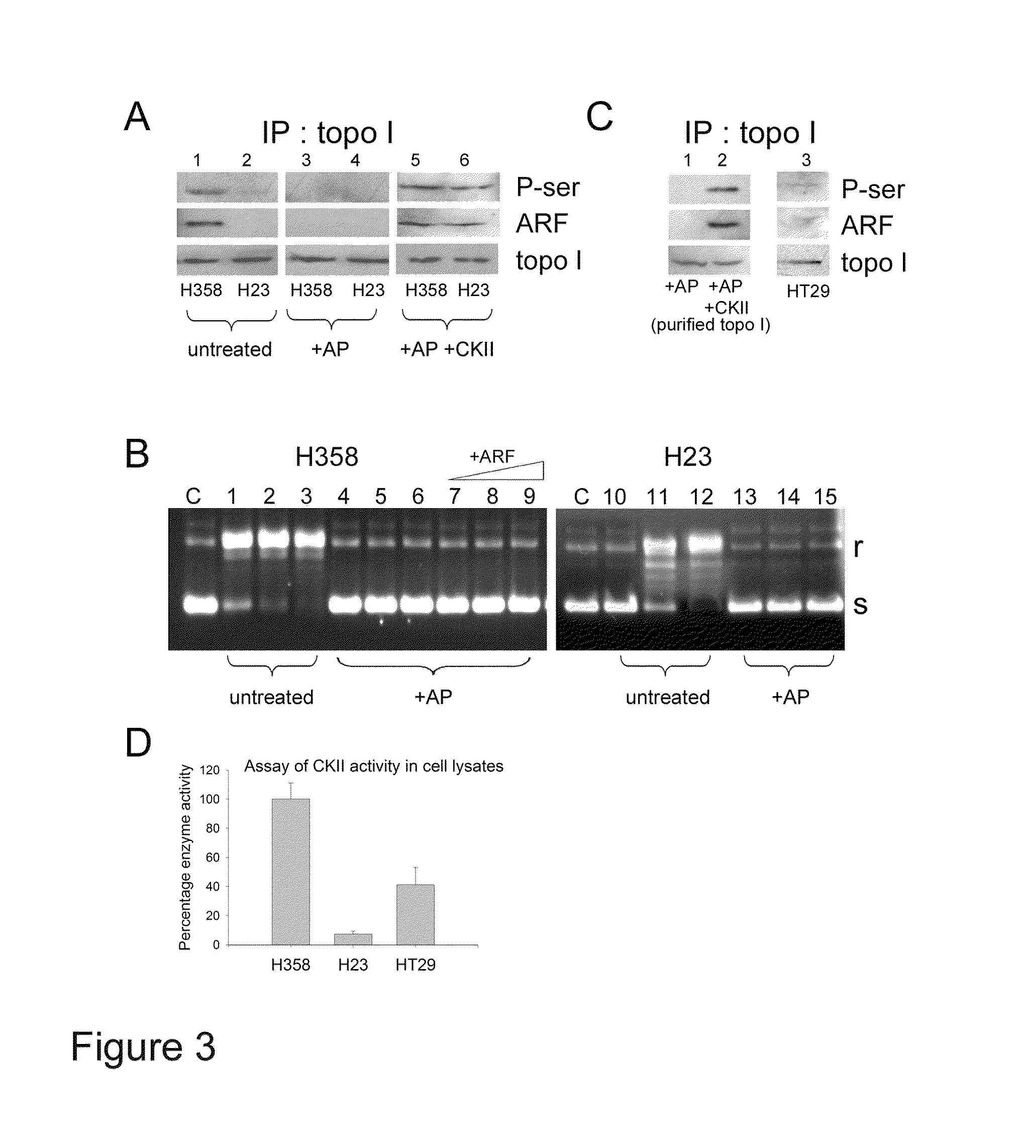 Methods and compositions for topoisomerase I modulated tumor suppression