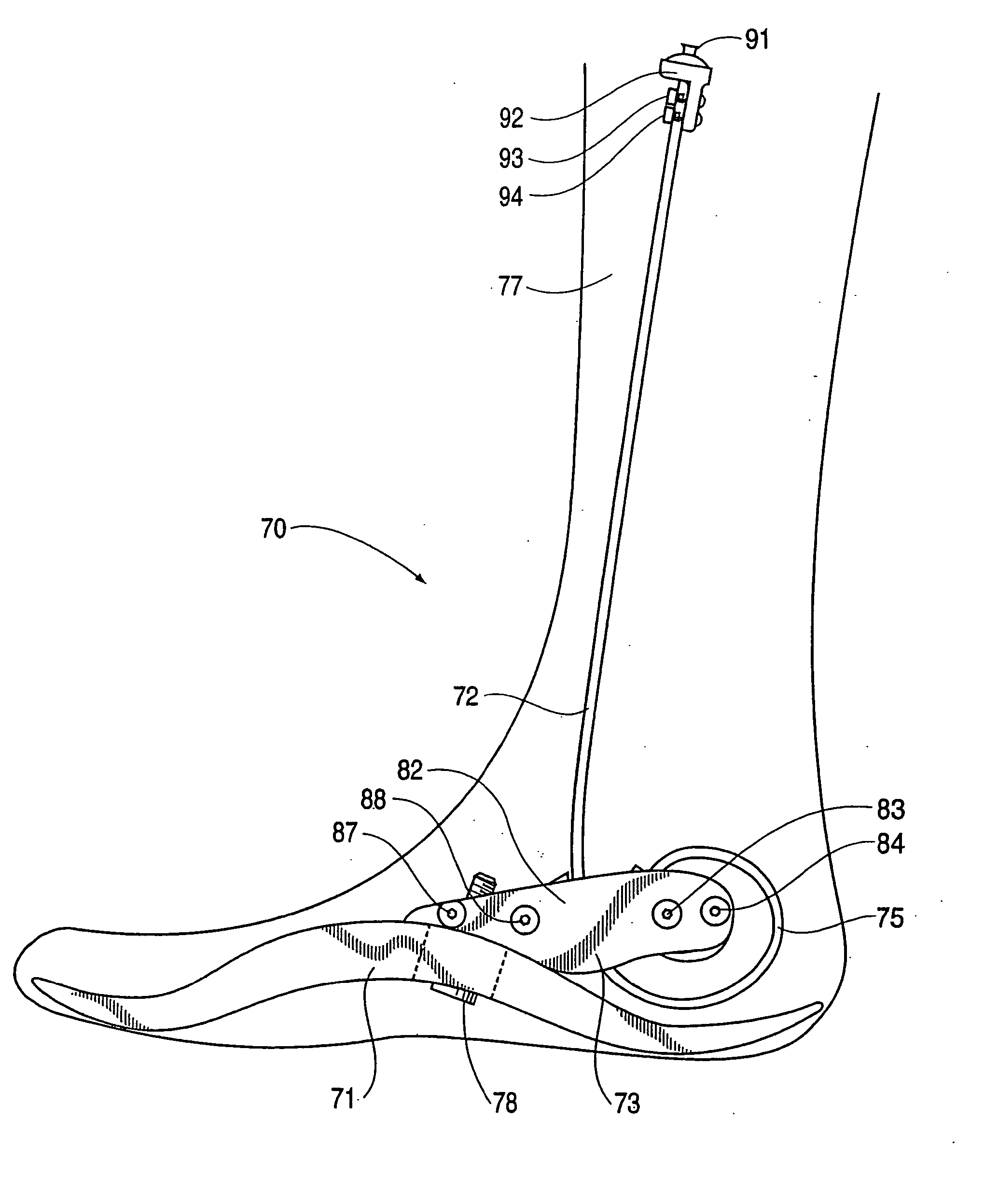 Prosthetic foot with tunable performance