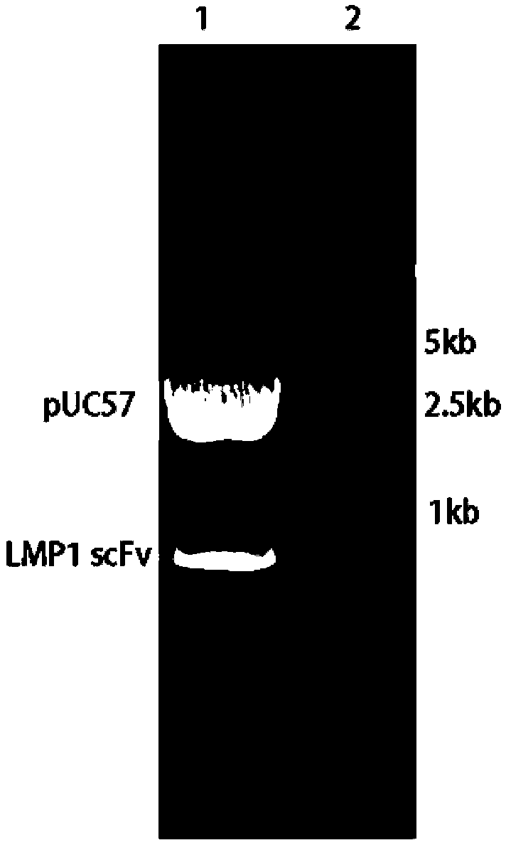 Chimeric antigen receptor and use thereof