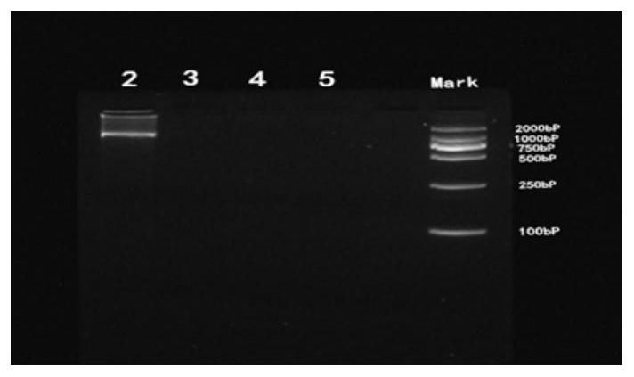 BRV serum neutralizing antibody titer level detection method based on IFA