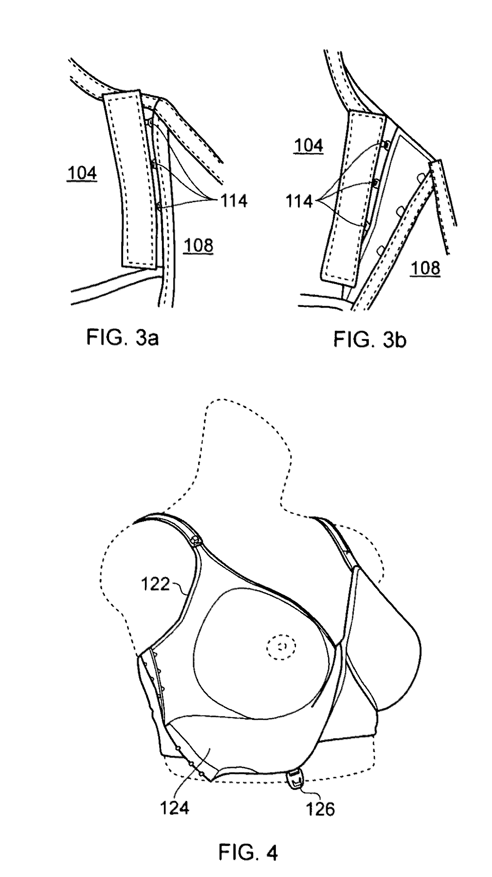 An Expandable Brassiere