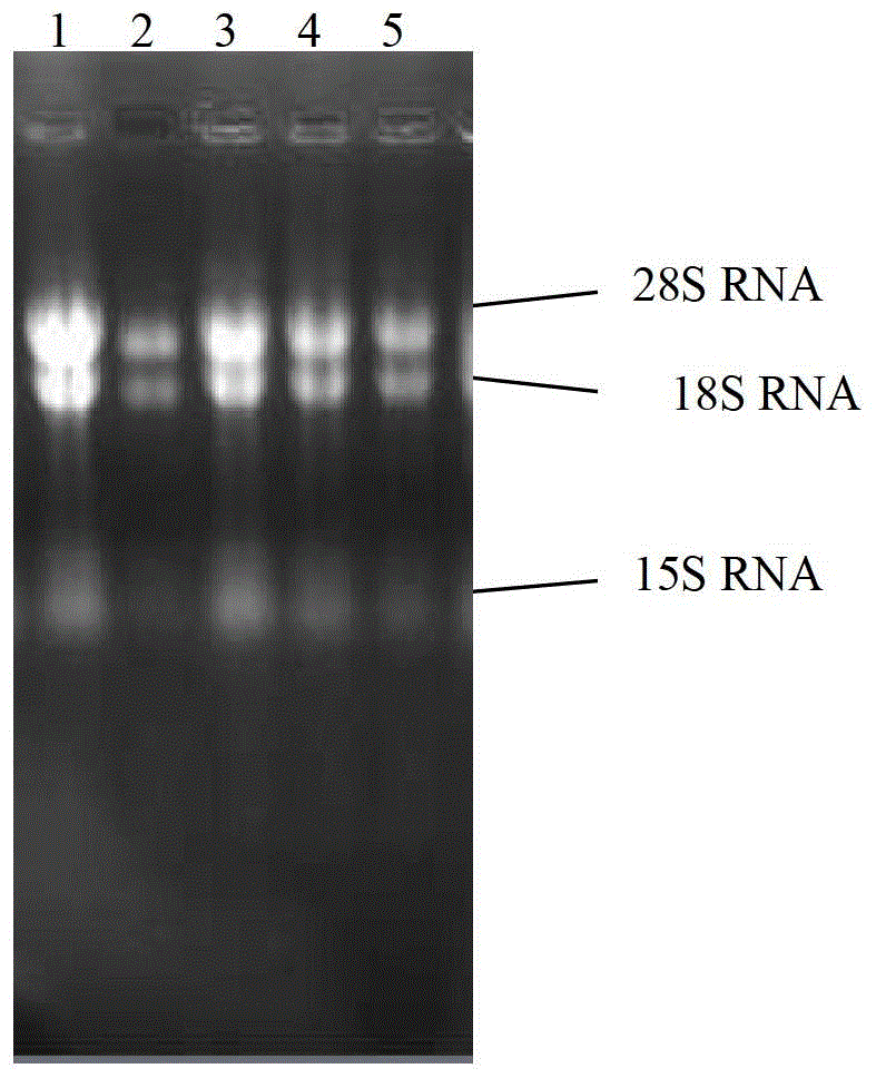 Cordyceps sinensis hirsutella sinensis purine anabolism enzyme, gene thereof, and application thereof