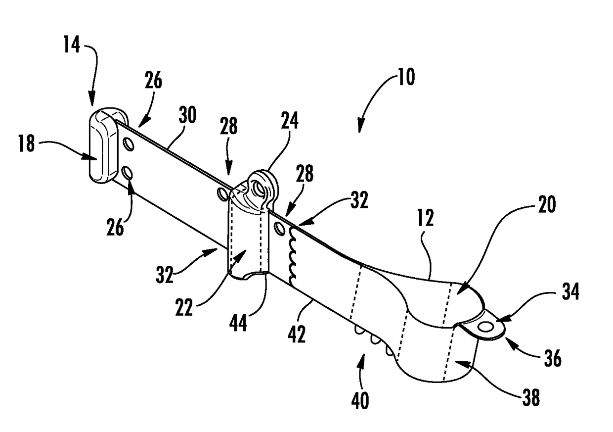 Circumferential matrix band