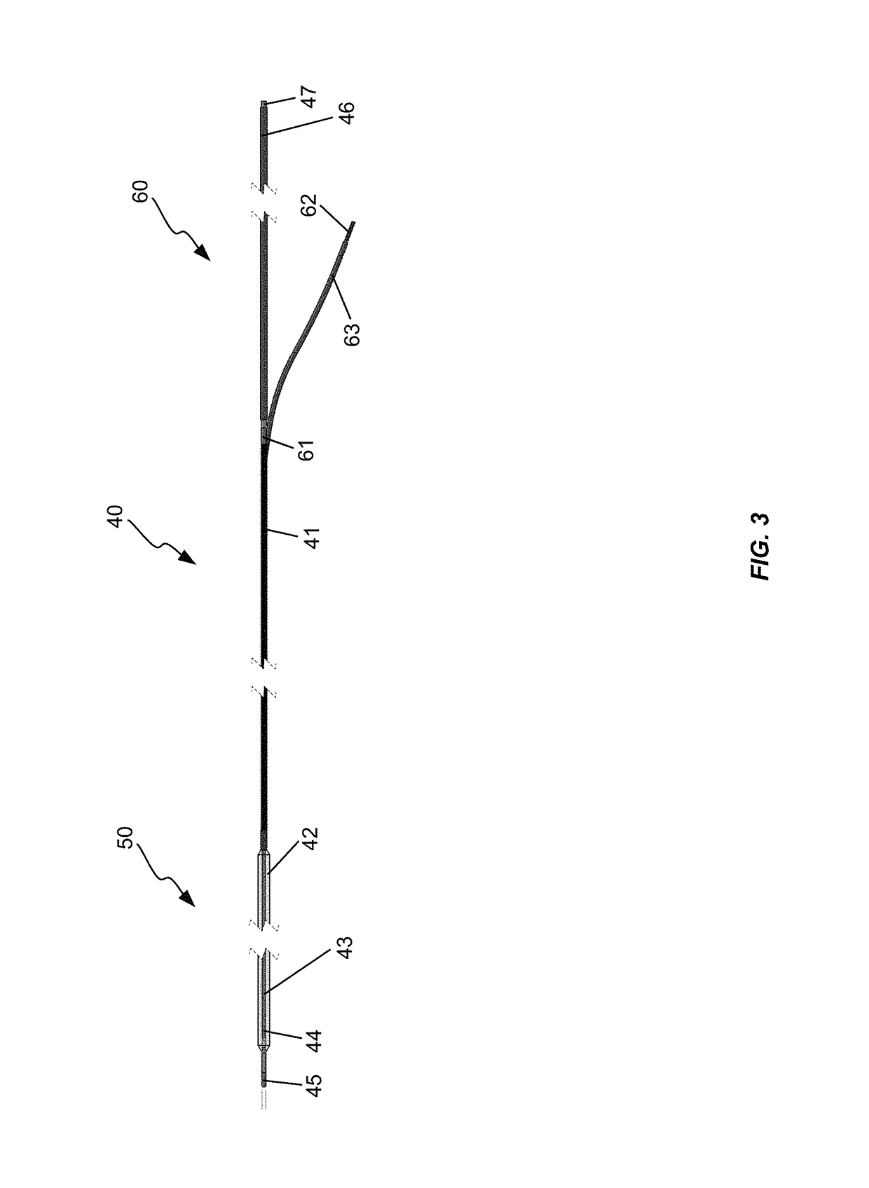 Elastic tip for an adjustable length angioplasty balloon sheath