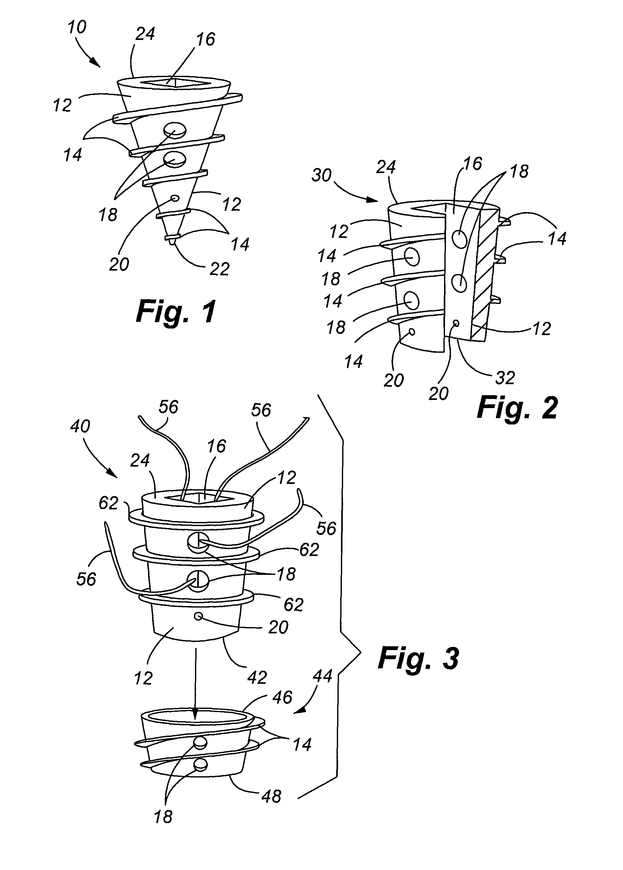 Bioelectric implant and method