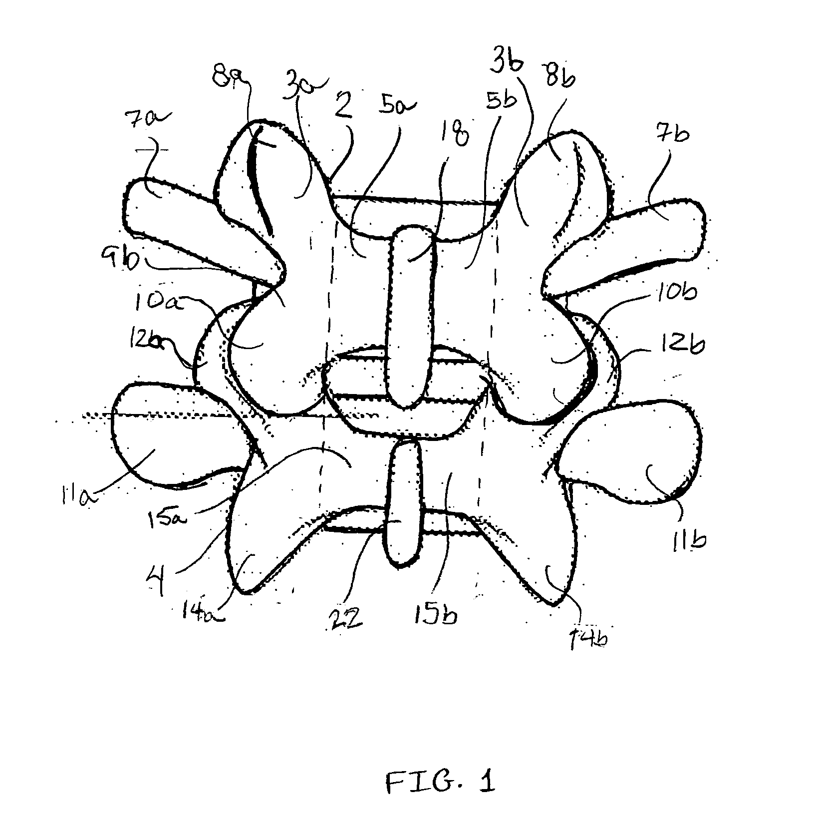 Systems and methods for stabilizing the motion or adjusting the position of the spine