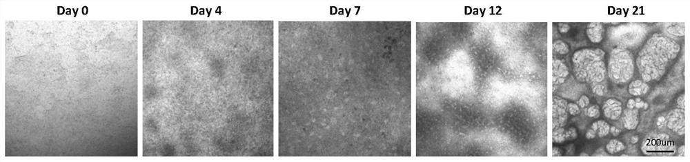 Method for establishing kidney organoids through stem cell induced differentiation