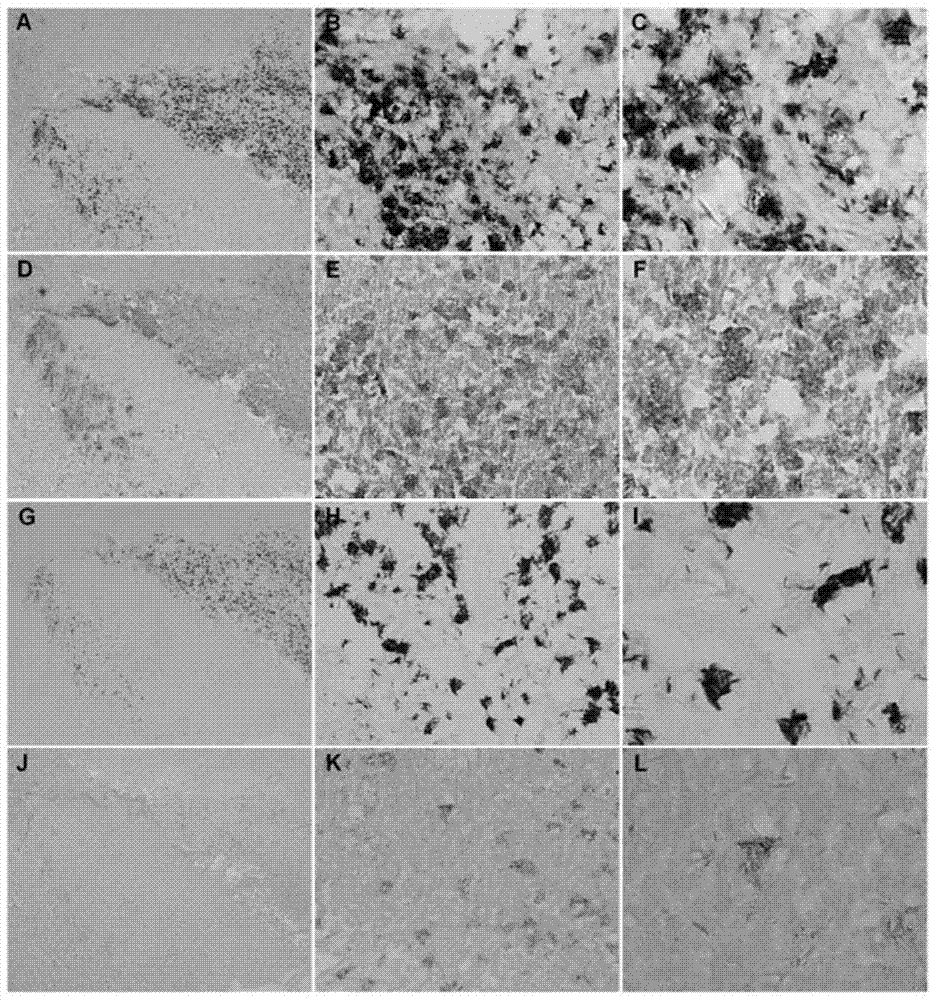 A kit and method for double staining of Mycobacterium tuberculosis and its antigen