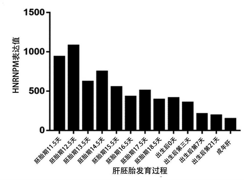 Application of reagent for detecting HNRNPM expression in preparation of medicine composition for diagnosing and/or prognostically judging liver cancer