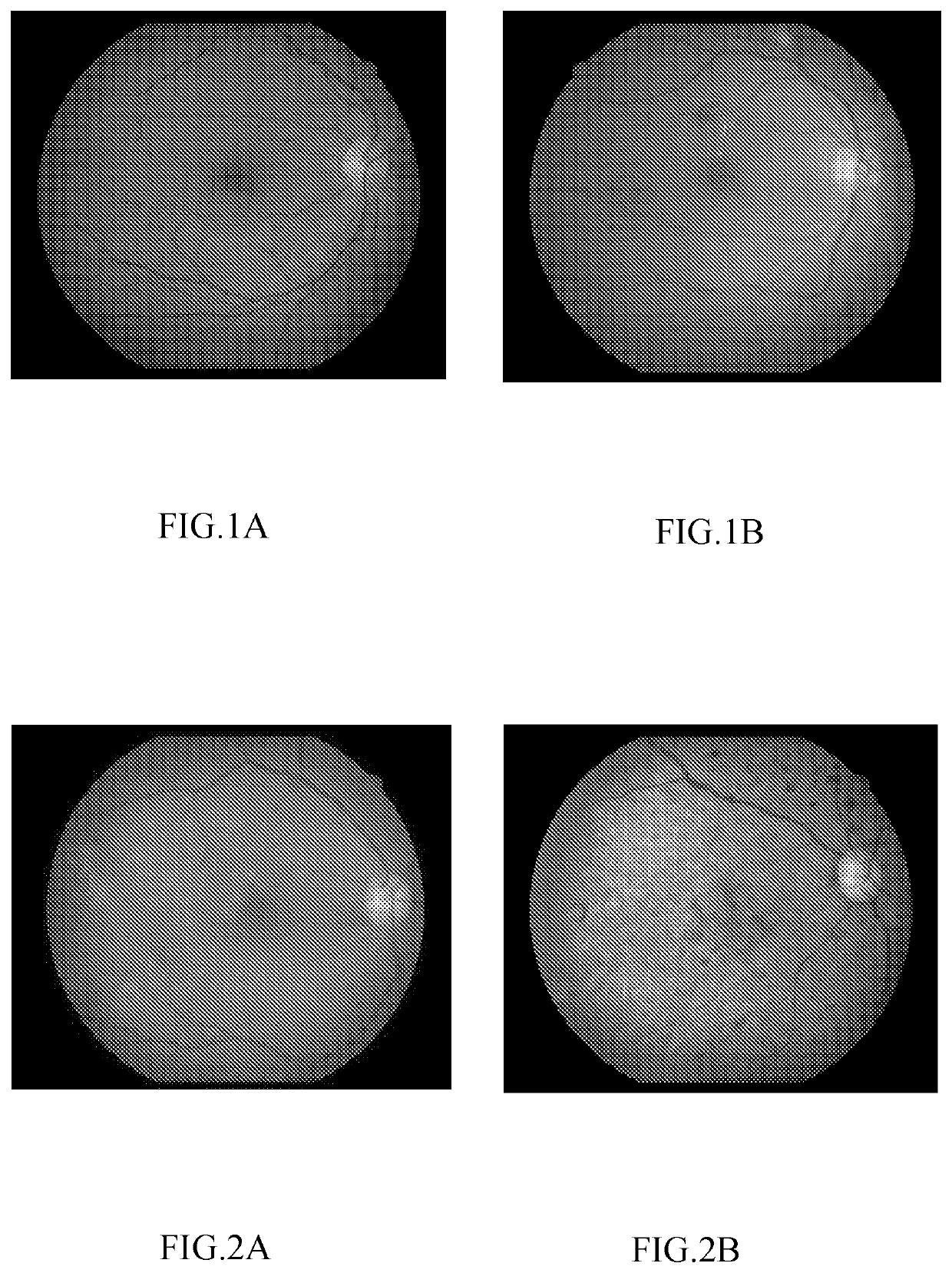 Artificial neural network and system for identifying lesion in retinal fundus image
