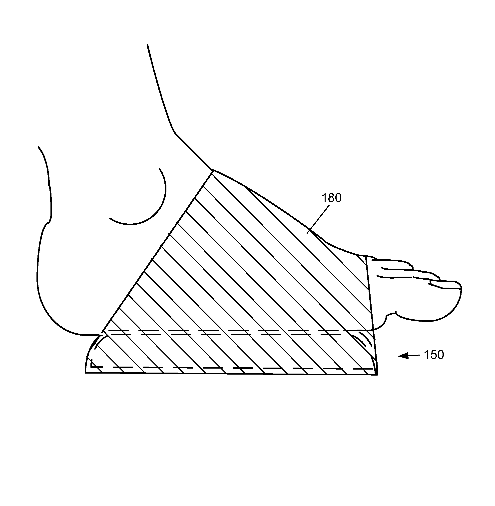 Apparatus for plantar fasciitis treatment and method for making same