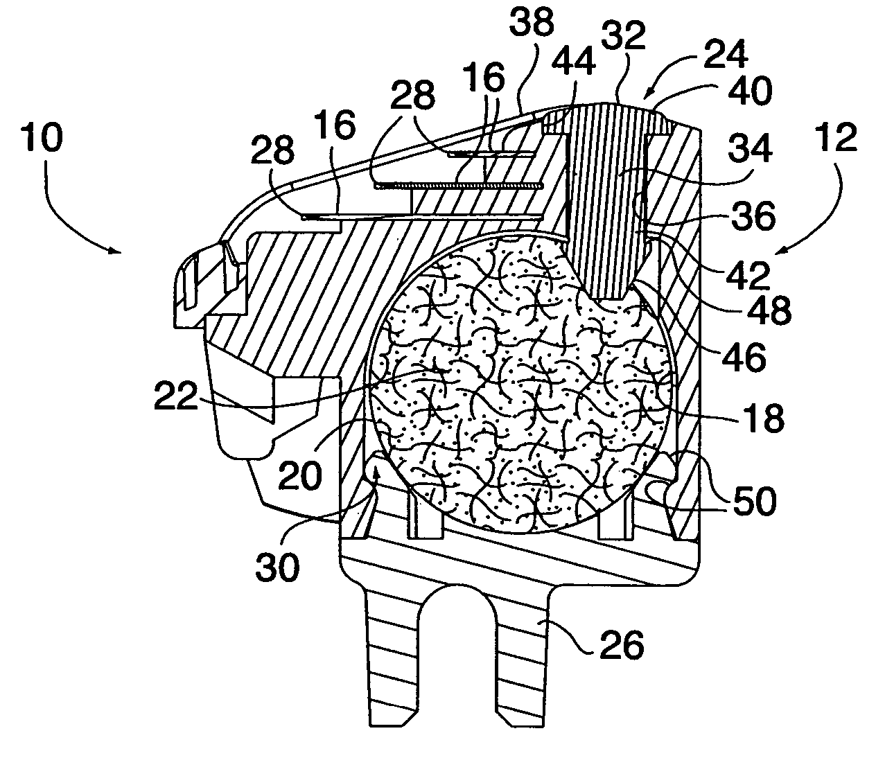 Shaving device with shaving aid material dispenser