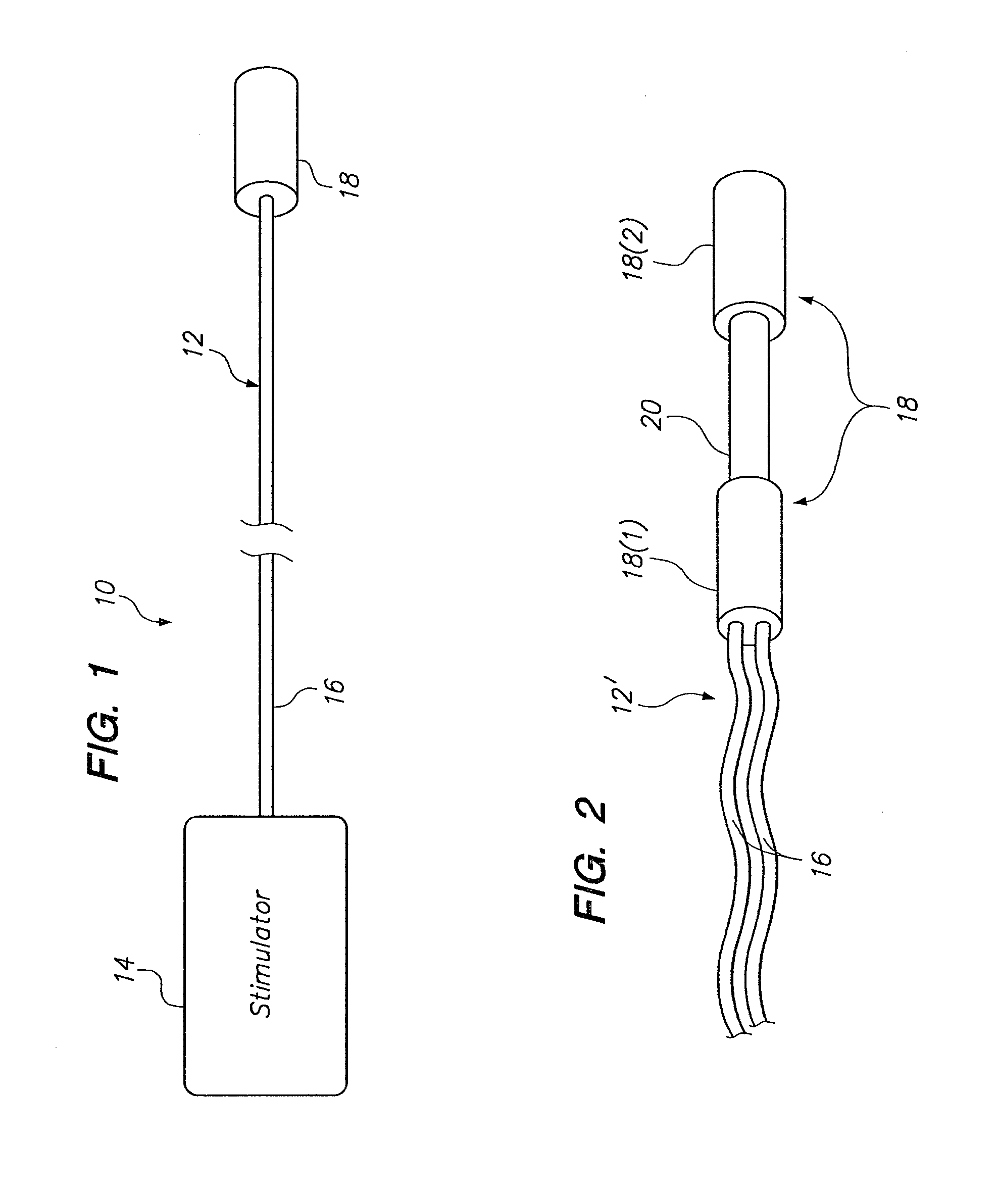 Method of stimulating fastigium nucleus to treat neurological disorders