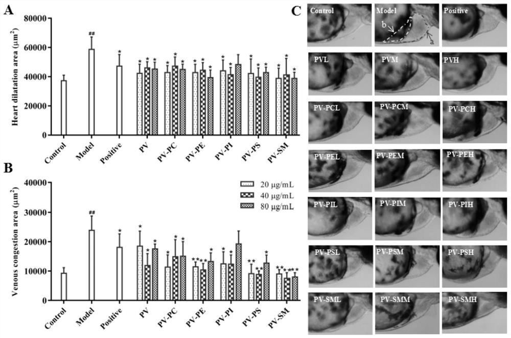 Application of marine phospholipids as active ingredients in the preparation of drugs for preventing and/or treating heart disease