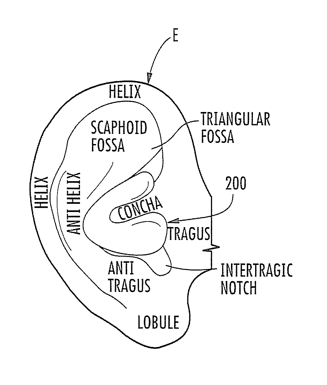 Form-fitted monitoring apparatus for health and environmental monitoring