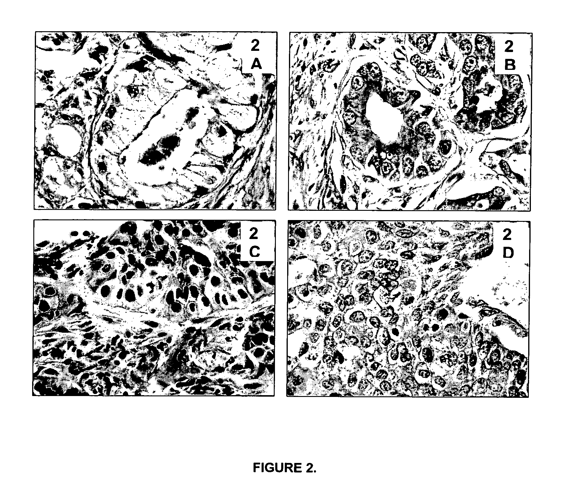 Methods, Reagents and Instrumentation for Preparing Impregnated Tissue Samples Suitable for Histopathological and Molecular Studies