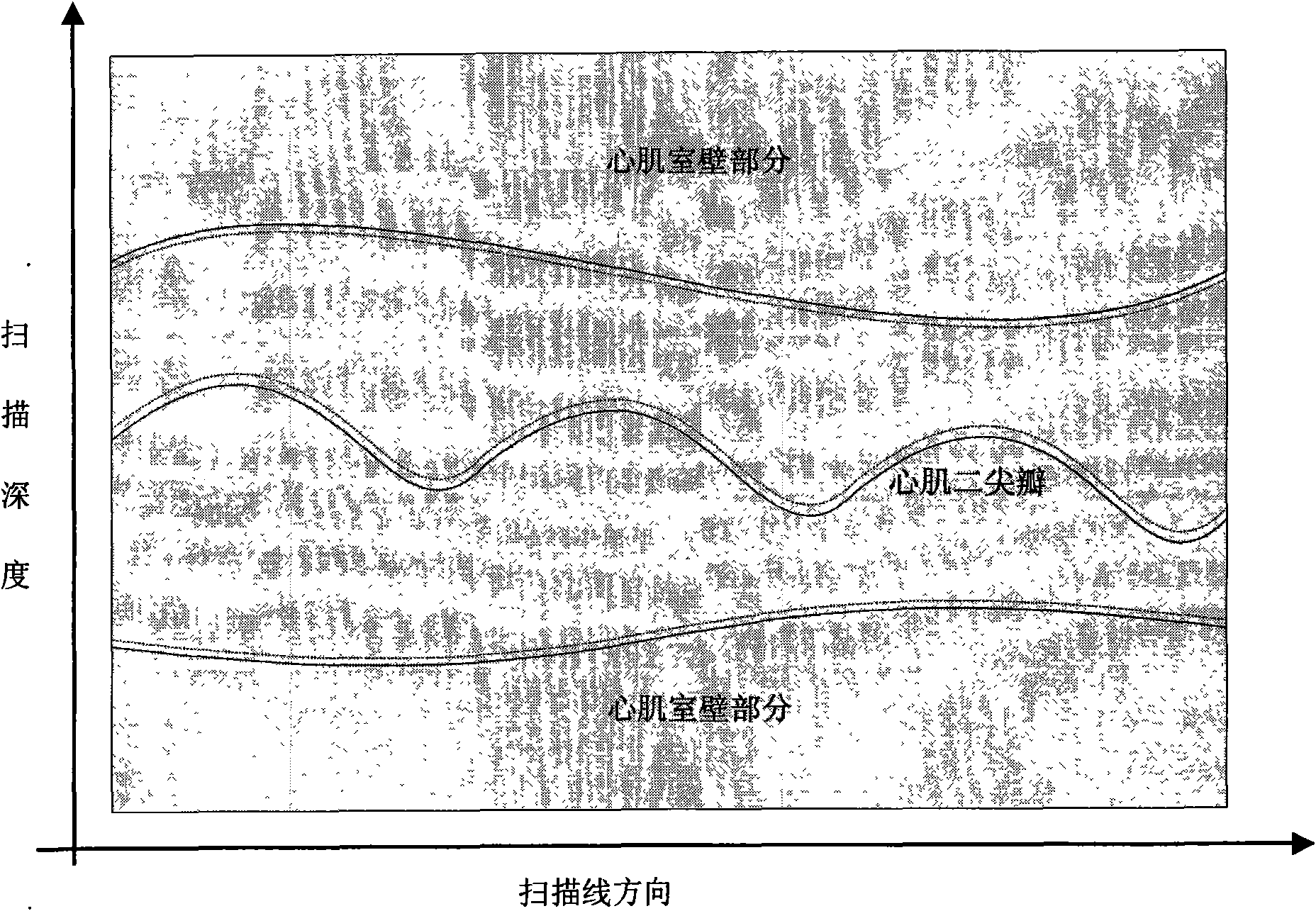 Method for tracking features of ultrasound pattern and system thereof