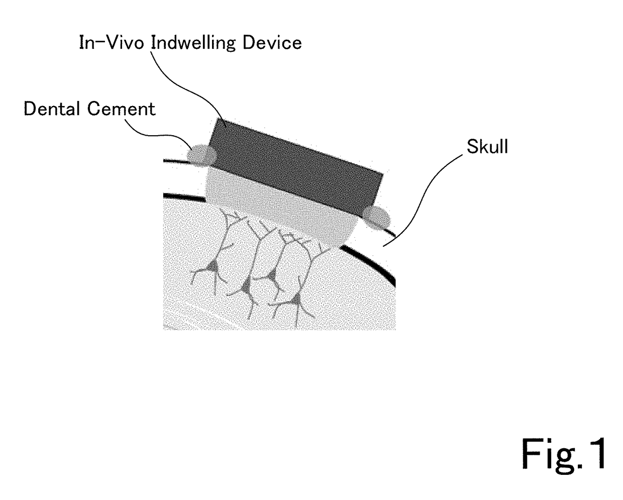 Translucent in-vivo indwelling device and utilization thereof