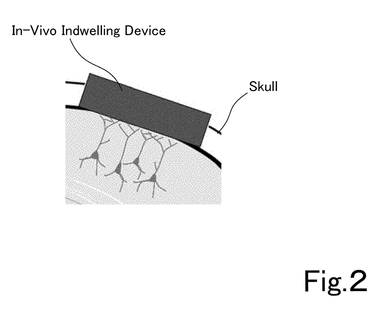 Translucent in-vivo indwelling device and utilization thereof