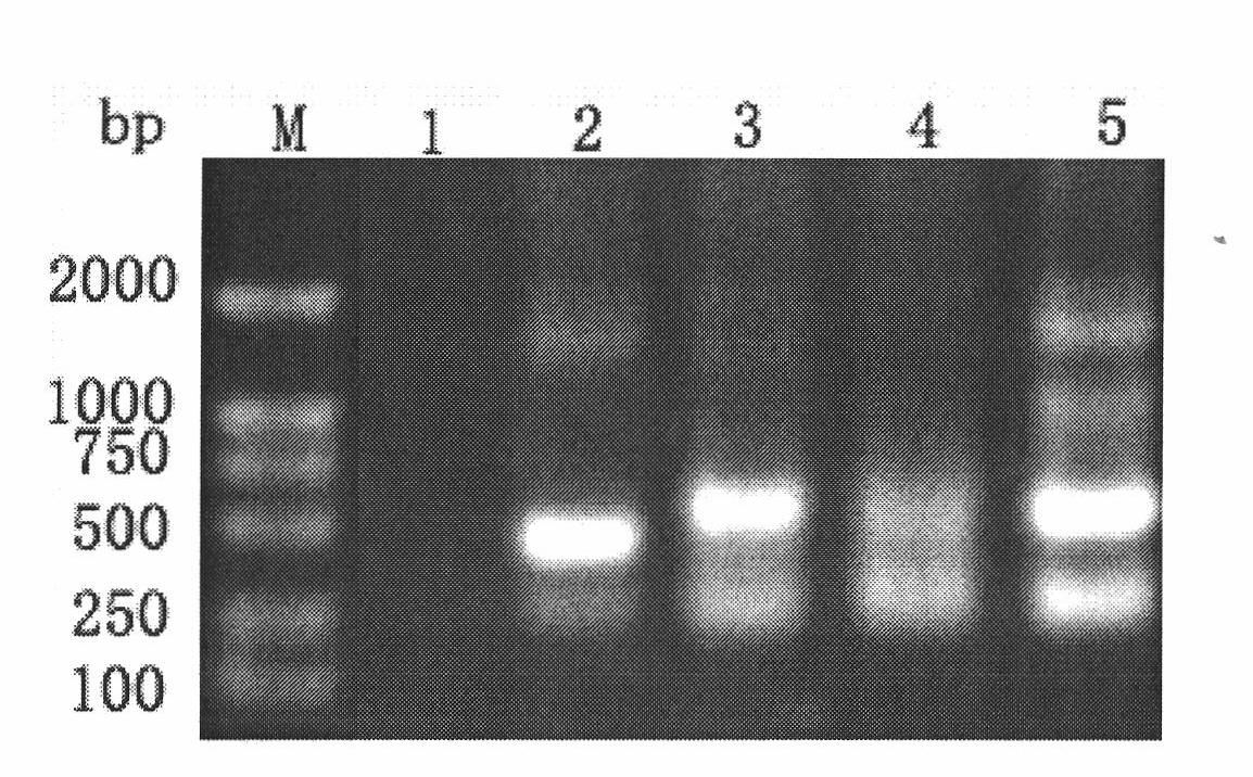 Yeast surface display of prawn white spot syndrome virus VP28 and application