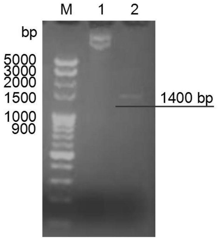 Recombinant vector, recombinant protein and virus-like particle of human papilloma virus 16-type epitope chimeric L1 as well as preparation and application thereof