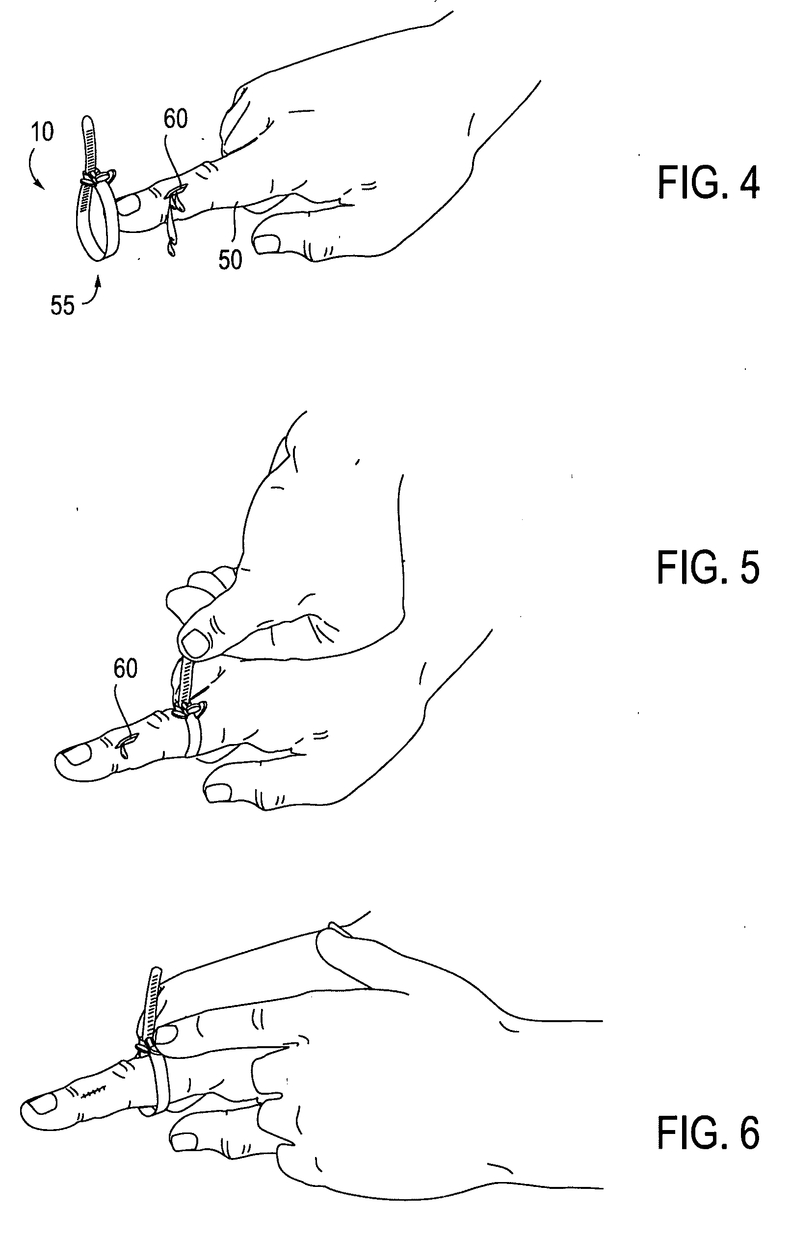 Method and apparatus for restricting blood flow